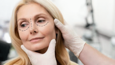 Looking to Refresh Your Eyes? What You Need to Know About Eyelid Surgery in Dubai