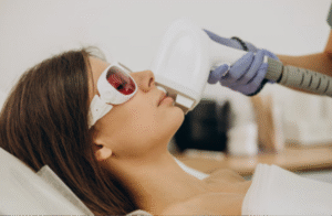 Best IPL Hair Removal Experience in Singapore 