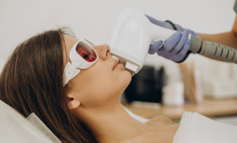 Best IPL Hair Removal Experience in Singapore 