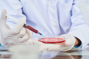 6 Ways Epidural Injection Pain Relief Can Support an Active Lifestyle